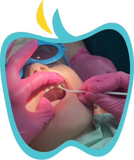 Babydent